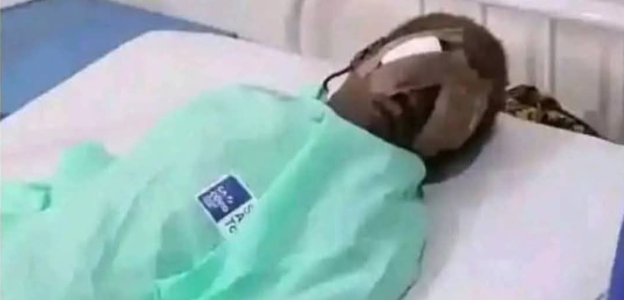 How 17-Year-Old Lured, Plucked Out Sister's Eyes For Rituals In Bauchi